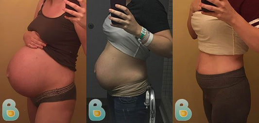 179-Cassie-H-Bellefit-Results-Before-and-After-Bellefit-SLIDE
