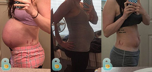 180-Nicole-J-Bellefit-Results-Before-and-After-Bellefit-SLIDE
