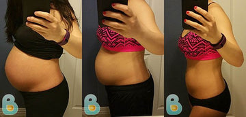 182-Ji-H-Bellefit-Results-Before-and-After-Bellefit-SLIDE