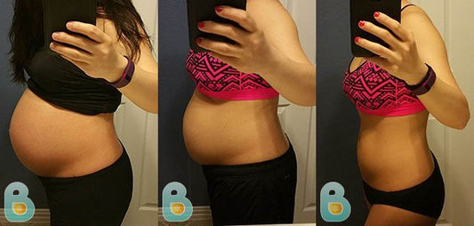 182-Ji-H-Bellefit-Results-Before-and-After-Bellefit-SLIDE