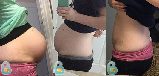 186-Annie-T-Bellefit-Results-Before-and-After-Bellefit-SLIDE