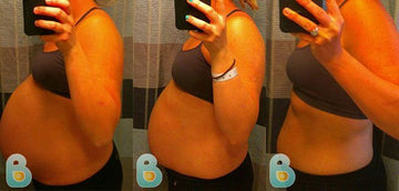 187-Emily-L-Bellefit-Results-Before-and-After-Bellefit-SLIDE
