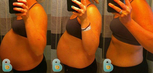 187-Emily-L-Bellefit-Results-Before-and-After-Bellefit-SLIDE