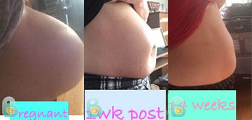 188-Lisa-P-Bellefit-Results-Before-and-After-Bellefit-SLIDE