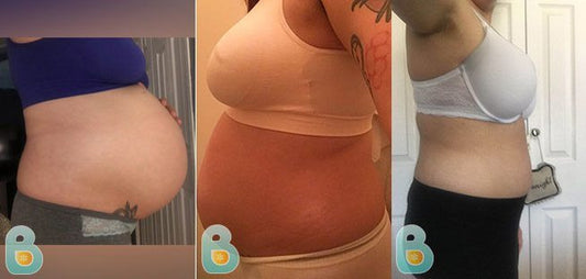 189-Brittainy-C-Bellefit-Results-Before-and-After-Bellefit-SLIDE
