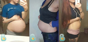 19-Ashley-M-Bellefit-Results-Before-and-After-Bellefit-SLIDE