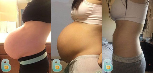 192-Melanie-G-Bellefit-Results-Before-and-After-Bellefit-SLIDE