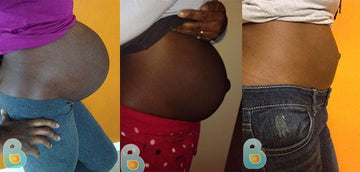 194-Marie-M-Bellefit-Results-Before-and-After-Bellefit-SLIDE