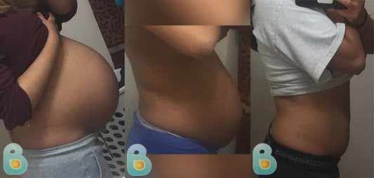 195-Leilani-R-Bellefit-Results-Before-and-After-Bellefit-SLIDE