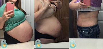 197-Kaleigh-M-Bellefit-Results-Before-and-After-Bellefit-SLIDE