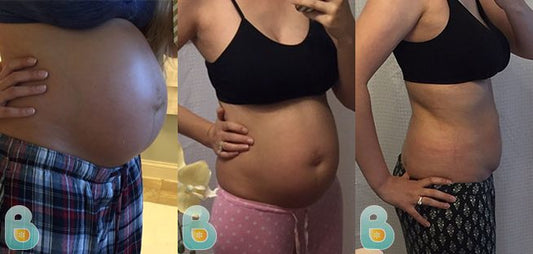198-Cara-W-Bellefit-Results-Before-and-After-Bellefit-SLIDE