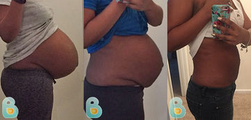 199-Janae-D-Bellefit-Results-Before-and-After-Bellefit-SLIDE