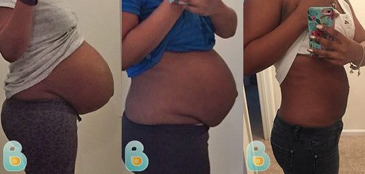 199-Janae-D-Bellefit-Results-Before-and-After-Bellefit-SLIDE