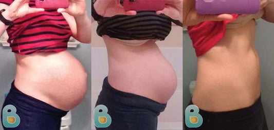 2-Adrienne-W-Bellefit-Results-Before-and-After-Bellefit-SLIDE