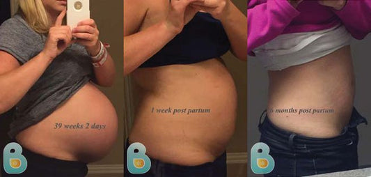 20-Ashley-V-Bellefit-Results-Before-and-After-Bellefit-SLIDE