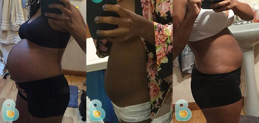 200-Amanda-D-Bellefit-Results-Before-and-After-Bellefit-SLIDE