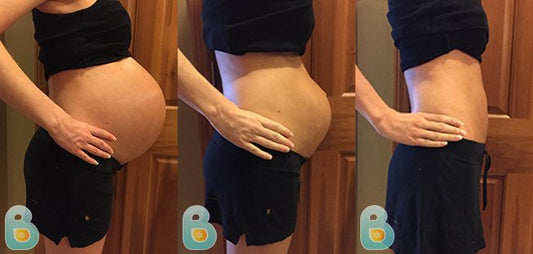 201-Christine-F-Bellefit-Results-Before-and-After-Bellefit-SLIDE