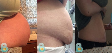 202-Kimberly-C-Bellefit-Results-Before-and-After-Bellefit-SLIDE