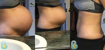 203-Lindsey-R-Bellefit-Results-Before-and-After-Bellefit-SLIDE-1