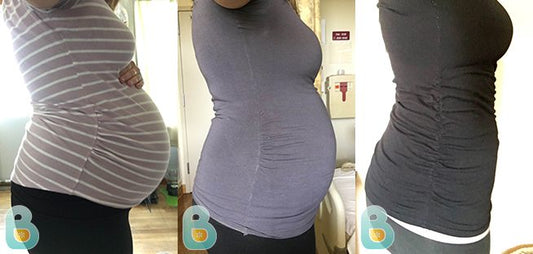 204-Roxane-M-Bellefit-Results-Before-and-After-Bellefit-SLIDE