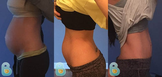 208-Charley-N-Bellefit-Results-Before-and-After-Bellefit-SLIDE
