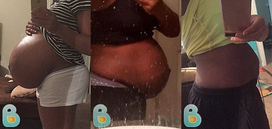 212-Kea-M-Bellefit-Results-Before-and-After-Bellefit-SLIDE