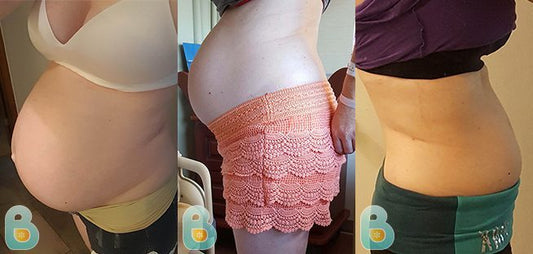 215-Haley-D-Bellefit-Results-Before-and-After-Bellefit-SLIDE