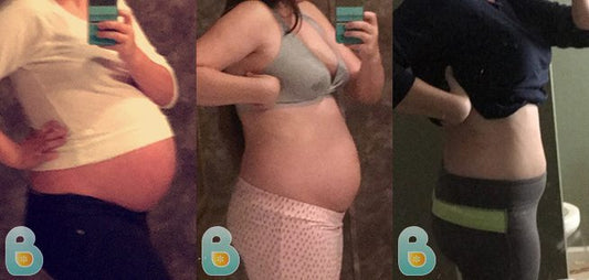 217-Megan-F-Bellefit-Results-Before-and-After-Bellefit-SLIDE