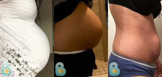 222-Jennifer-C-Bellefit-Results-Before-and-After-Bellefit-SLIDE