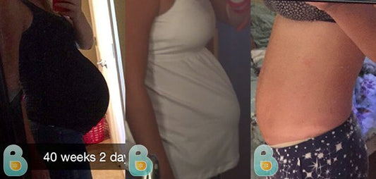 223-Lindsay-G-Bellefit-Results-Before-and-After-Bellefit-SLIDE