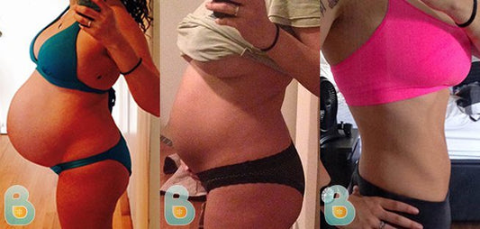 224-Tatiana-F-Bellefit-Results-Before-and-After-Bellefit-SLIDE