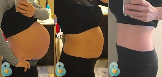 226-Dalaina-M-Bellefit-Results-Before-and-After-Bellefit-SLIDE