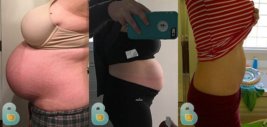 227-Nicole-J-Bellefit-Results-Before-and-After-Bellefit-SLIDE