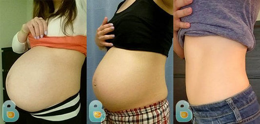 228-Brianna-D-Bellefit-Results-Before-and-After-Bellefit-SLIDE