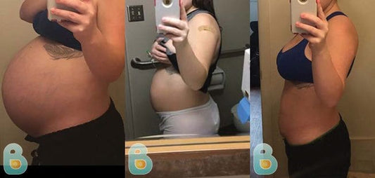 23-Brandy-C-Bellefit-Results-Before-and-After-Bellefit-SLIDE
