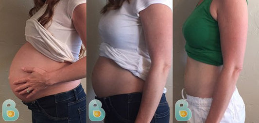 231-Mischa-T-Bellefit-Results-Before-and-After-Bellefit-SLIDE