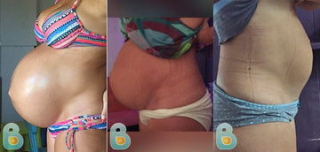 232-Melanie-L-Bellefit-Results-Before-and-After-Bellefit-SLIDE