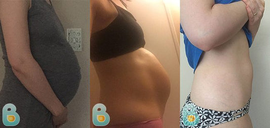 233-Michelle-K-Bellefit-Results-Before-and-After-Bellefit-SLIDE