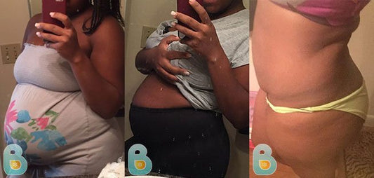 239-Ivory-D-Bellefit-Results-Before-and-After-Bellefit-SLIDE