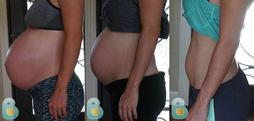 240-Holly-S-Bellefit-Results-Before-and-After-Bellefit-SLIDE