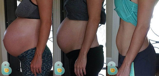 240-Holly-S-Bellefit-Results-Before-and-After-Bellefit-SLIDE