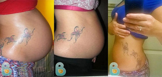 242-Jessica-P-Bellefit-Results-Before-and-After-Bellefit-SLIDE