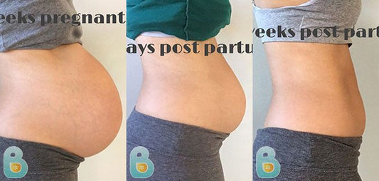 244-Brandie-F-Bellefit-Results-Before-and-After-Bellefit-SLIDE