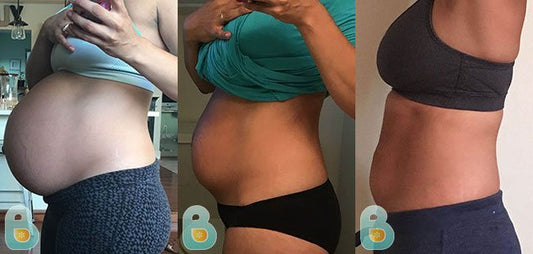 247-Vanessa-F-Bellefit-Results-Before-and-After-Bellefit-SLIDE