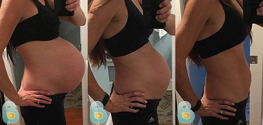 249-Amy-M-Bellefit-Results-Before-and-After-Bellefit-SLIDE