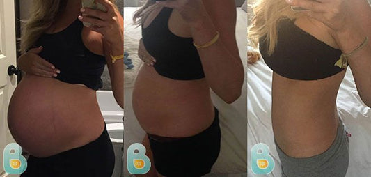 250-Meghan-K-Bellefit-Results-Before-and-After-Bellefit-SLIDE