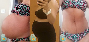 251-Savannah-V-Bellefit-Results-Before-and-After-Bellefit-SLIDE
