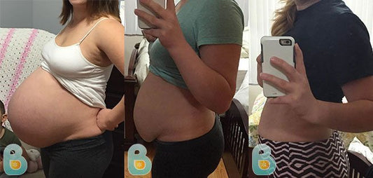 253-Alma-P-Bellefit-Results-Before-and-After-Bellefit-SLIDE