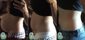 257-Gretchen-S-Bellefit-Results-Before-and-After-Bellefit-SLIDE