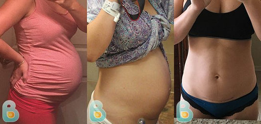 258-Heidi-S-Bellefit-Results-Before-and-After-Bellefit-SLIDE